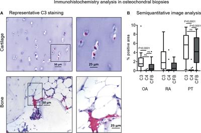 Complement Expression and Activation in Osteoarthritis Joint Compartments